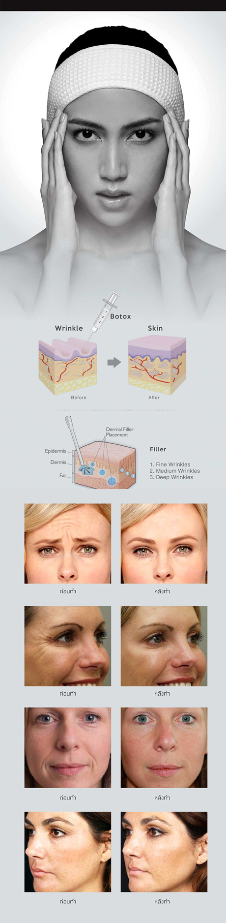 Facial Design