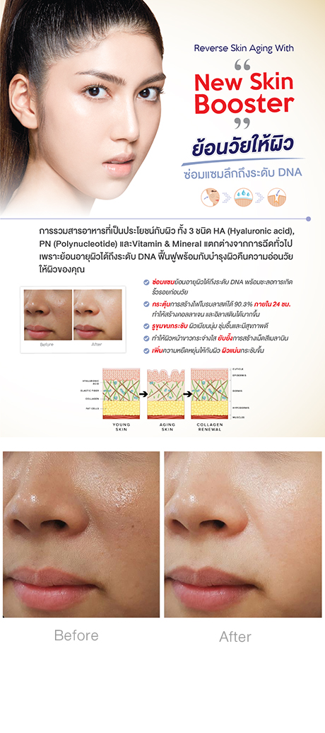 NEW Skin Booster NEW Skin Booster