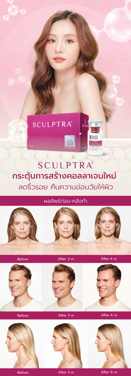 Sculptra® Sculptra®